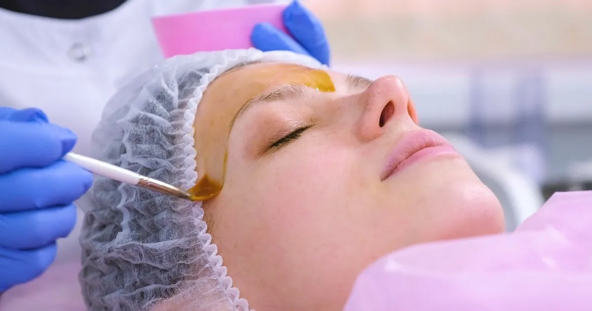 Women receiving Chemical Peel in Sulphur Springs, TX